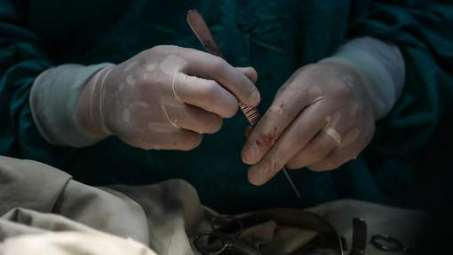 Un chef de cartel assassiné lors d'une opération pour changer de visage Un chef de cartel assassiné lors d'une opération pour changer de visage