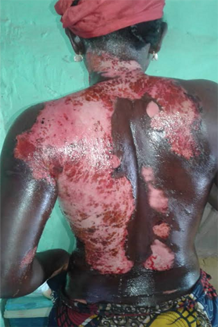 Kaffrine : Une femme ébouillante sa co-épouse [Photos]