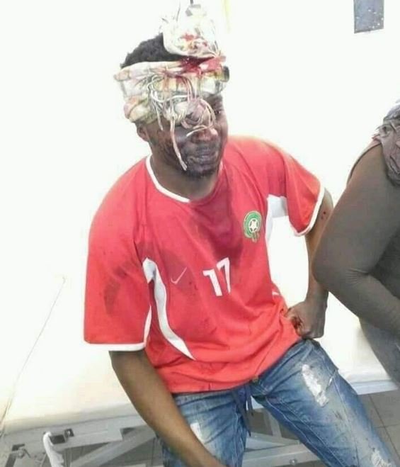 Maroc: Un étudiant violemment agressé