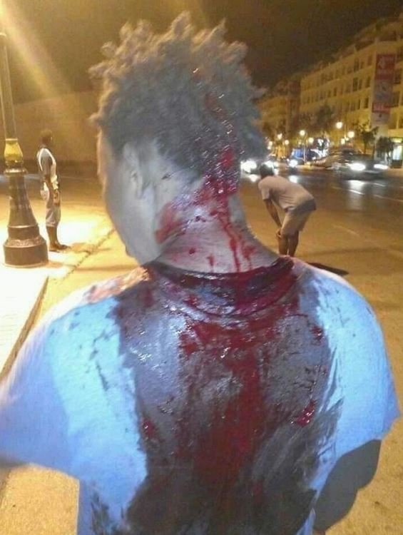 Maroc: Un étudiant violemment agressé