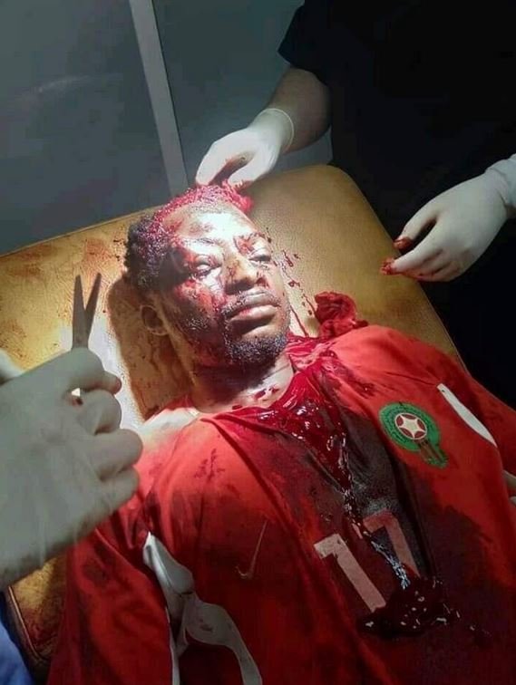 Maroc: Un étudiant violemment agressé
