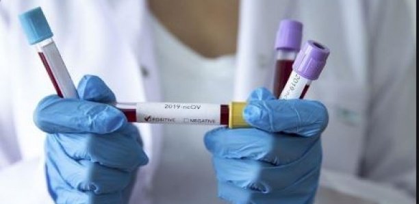 Covid-19 : « Le Sénégal est en train de travailler sur un vaccin », (Institut-Pasteur)