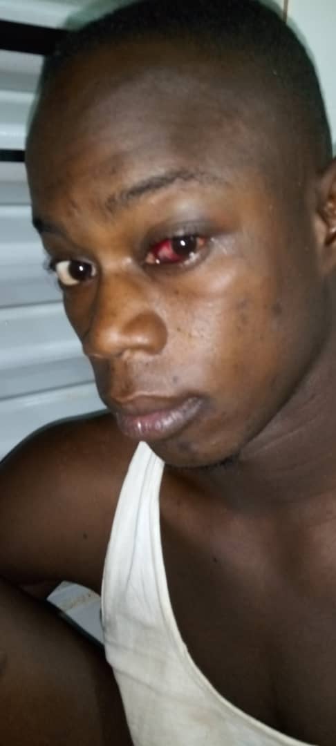 Youssou Diouf: "L'adjudant de police Oumar Dogue du commissariat de Bambey m'a convoqué, battu et torturé (...)"