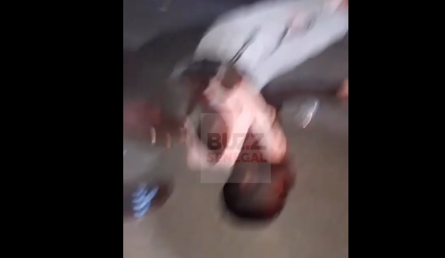 Kaolack : Le jeune homme de 25 ans percuté hier par un véhicule de la police, se porte bien.