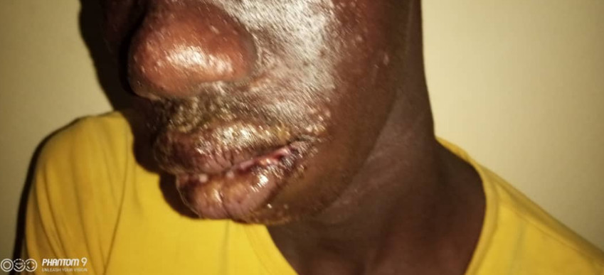 Thiaroye-Sur-Mer: Une mystérieuse maladie sème le trouble dans la localité (Âmes sensibles s'abstenir)