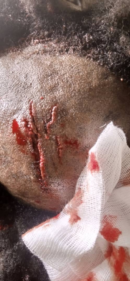 Du sang a giclé à Podor- Affrontements entre partisans du ministre Abdoulaye Daouda Diallo et des jeunes de "Fouta Debout" (audio et vidéos)