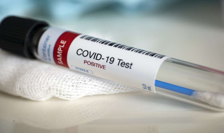COVID-19 : 30 NOUVEAUX CAS, 4 DÉCÈS ET 31 EN RÉANIMATION
