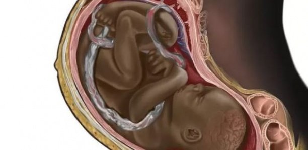 Les illustrations de cet étudiant nigérian chamboulent les manuels de médecine moderne