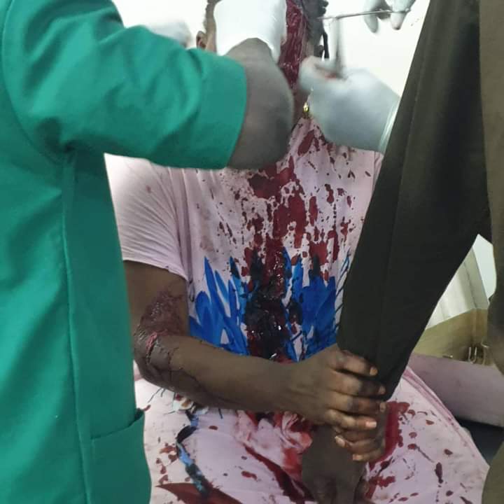 ​MÉDINA-  Une militante de Cheikh Ba  sauvagement agressée par une inconditionnelle du maire sortant, Bamba Fall