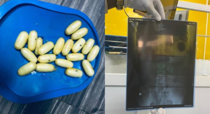 KAOLACK : DE LA DROGUE ET DES MÉDICAMENTS PROHIBÉS INCINÉRÉS PAR LA DOUANE AU CENTRE DU PAYS