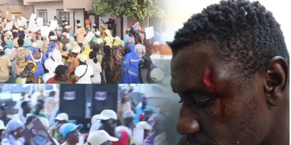 Mbour : 4 blessés enregistrés durant des échauffourées entre militants du parti au pouvoir
