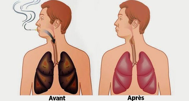 Ces aliments nettoient vos poumons de la nicotine et des goudrons Ces aliments nettoient vos poumons de la nicotine et des goudrons