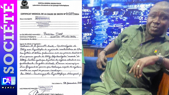 Mort de Bassirou Diop : ce que révèle l’autopsie  