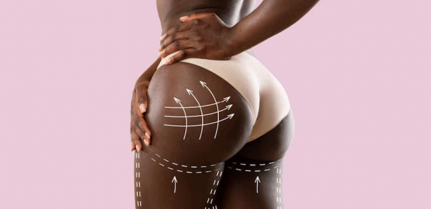 Sirops pour prise de poids, boulettes pour fesses : aux sources du mal, le culte de la femme " taata guine"