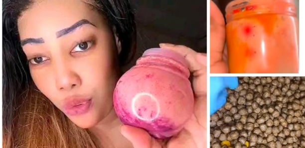 Boulettes de fesses : Vers la libération de Alima Suppo