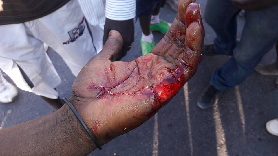 Encore les démons  de la violence qui tapent à l'incruste dans cette campagne au référendum!