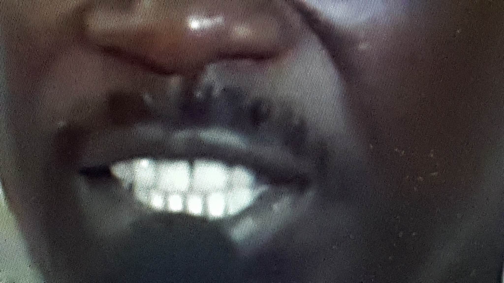 Arrêt sur image! Seydou Guèye et Mimi Touré recourent aux implants dentaires (la preuve par les images)