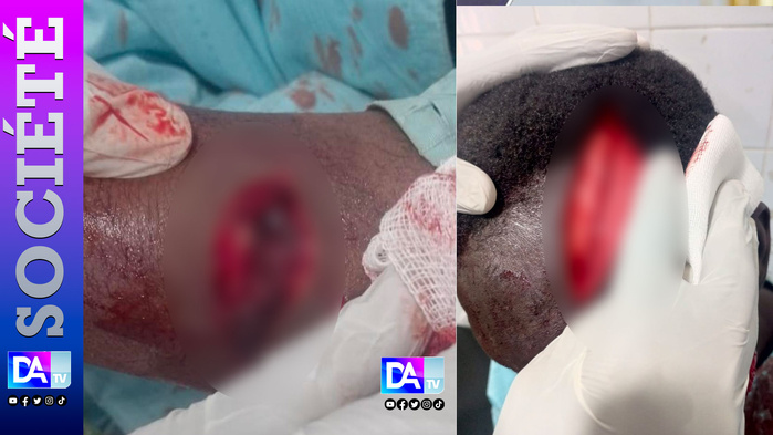 TOUBA – Un berger blesse grièvement avec une machette un maître coranique et prend la fuite.