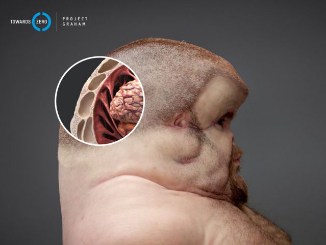 Voici Graham, l'humain (immonde) conçu pour survivre à un accident de la route