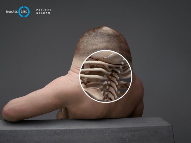 Voici Graham, l'humain (immonde) conçu pour survivre à un accident de la route