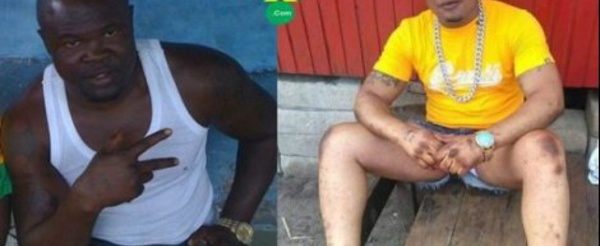 Le boxeur ghanéen Bukom Banku : « Déçu d’être noir, j’ai enfin réussi à devenir blanc »