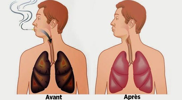 Ces aliments nettoient vos poumons de la nicotine et des goudrons