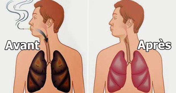 Le saviez-vous? Ces  aliments qui nettoient vos poumons des goudrons et de la nicotine