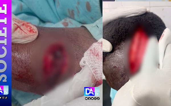 TOUBA – Un berger blesse grièvement avec une machette un maître coranique et prend la fuite.