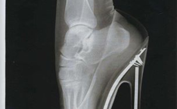 Un pied dans une chaussure à talon….Le tout passé au rayon X .