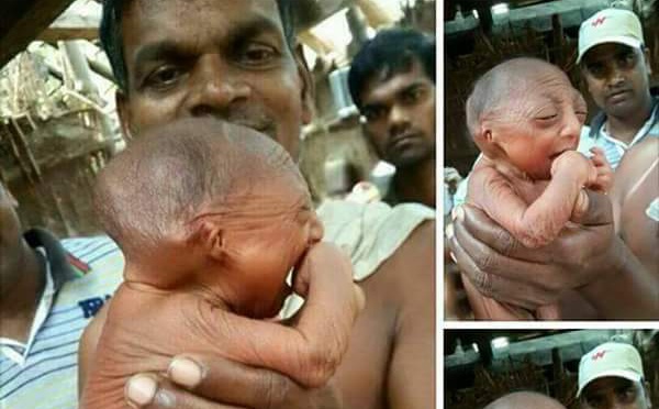 Incroyable, mais vrai!                Ce bebe est né au Bangladesh , il a... 130 ans !