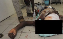 Hôpital Aristide Le Dantec : visite aux mutilés de Rebeuss atteints par balle Hôpital Aristide Le Dantec : visite aux mutilés de Rebeuss atteints par balle