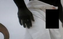 Mbacké – La seconde épouse mord jusqu’au sang le sexe de son mari