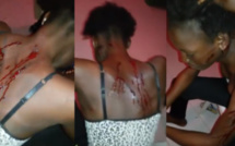 Il bat à sang sa femme pour une banale affaire de…