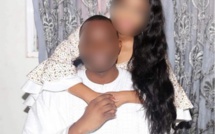 (Urgent) – Le mari qui a été brulé par sa femme est décédé
