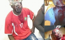 Maroc: Un étudiant violemment agressé Maroc: Un étudiant violemment agressé