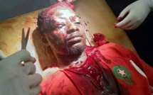 Maroc: Un étudiant violemment agressé Maroc: Un étudiant violemment agressé