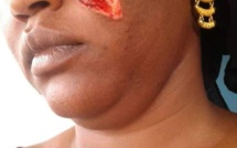 Ne pouvant plus supporter les cris de son bébé, il tabasse et mord sa femme à la joue