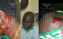 Violence dans les stades : As Pikine et Casa sports se donnent en spectacle
