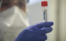 Coronavirus/ Direction Sicap : Le cas positif était au Burkina