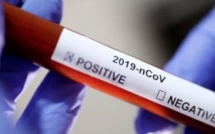 Covid-19 : 7 cas positifs enregistrés à Vélingara