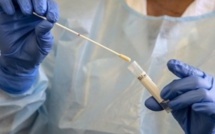 Covid-19 : Un kit de test rapide attendu sur le marché en juin