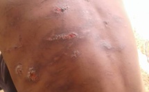  Thiès : Trois talibés gambiens sauvagement lynchés par leur marabout.