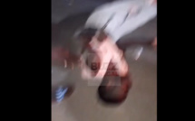 Kaolack : Le jeune homme de 25 ans percuté hier par un véhicule de la police, se porte bien.