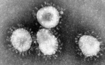 Épidémie: La fièvre jaune emporte deux vies à Kidira