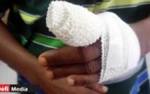 École Abass Sall : Une élève de 5 ans amputée du doigt après avoir été battue par sa maîtresse