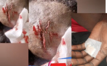 Du sang a giclé à Podor- Affrontements entre partisans du ministre Abdoulaye Daouda Diallo et des jeunes de "Fouta Debout" (audio et vidéos)