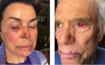 CE QUE L'ON SAIT DU VIOLENT "HOME JACKING" DE BERNARD TAPIE ET SON ÉPOUSE