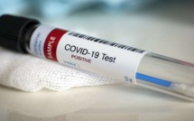 COVID-19 : 30 NOUVEAUX CAS, 4 DÉCÈS ET 31 EN RÉANIMATION