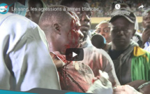 Le sang, les agressions à armes blanches: Cette autre face hideuse de la lutte sénégalaise