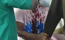 ​MÉDINA-  Une militante de Cheikh Ba  sauvagement agressée par une inconditionnelle du maire sortant, Bamba Fall